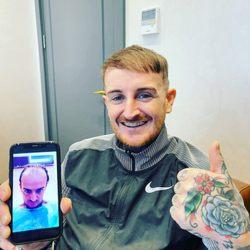 Slider image (5) Transes Hair Transplant